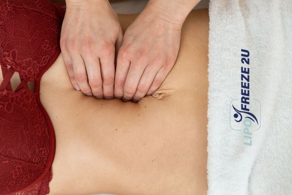 diastasis recti treatment Nantwich