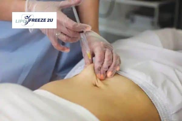How Does Aqualyx Fat Dissolving Injection Work to Break Down Fat Nantwich?