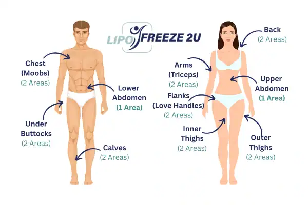 Areas you can have fat freezing treatment Nantwich