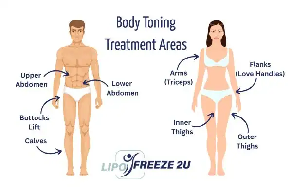 Graphic showing where you can have Body toning Treatment Nantwich on your body