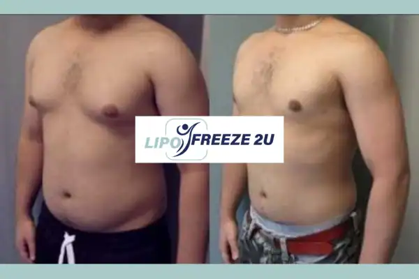 How Long Does It Take to See Results Nantwich?