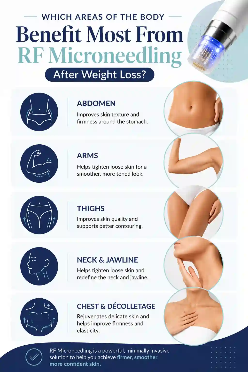 Which Areas of the Body Benefit Most From RF Microneedling After Weight Loss Nantwich